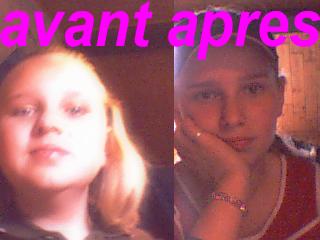 avant-apres